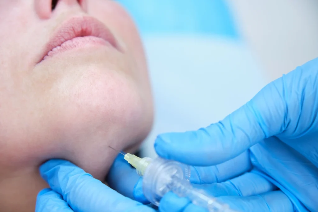 eliminar flacidez de cuello y papada 1