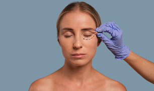 Blefaroplastia inferior imagen