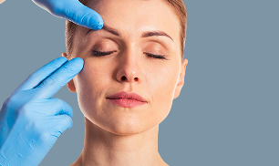 Blefaroplastia superior imagen