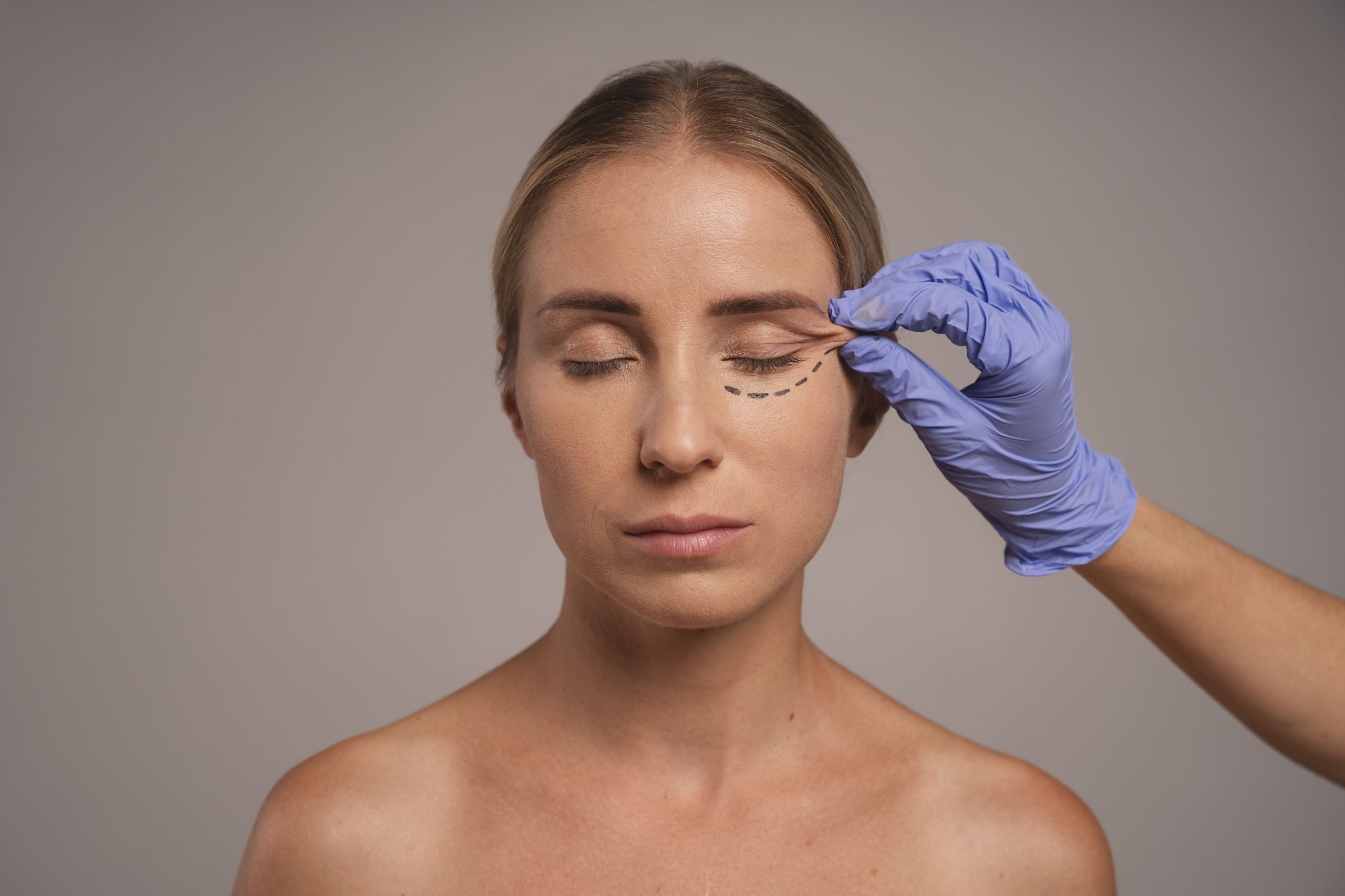 todo-sobre-blefaroplastia-cordoba