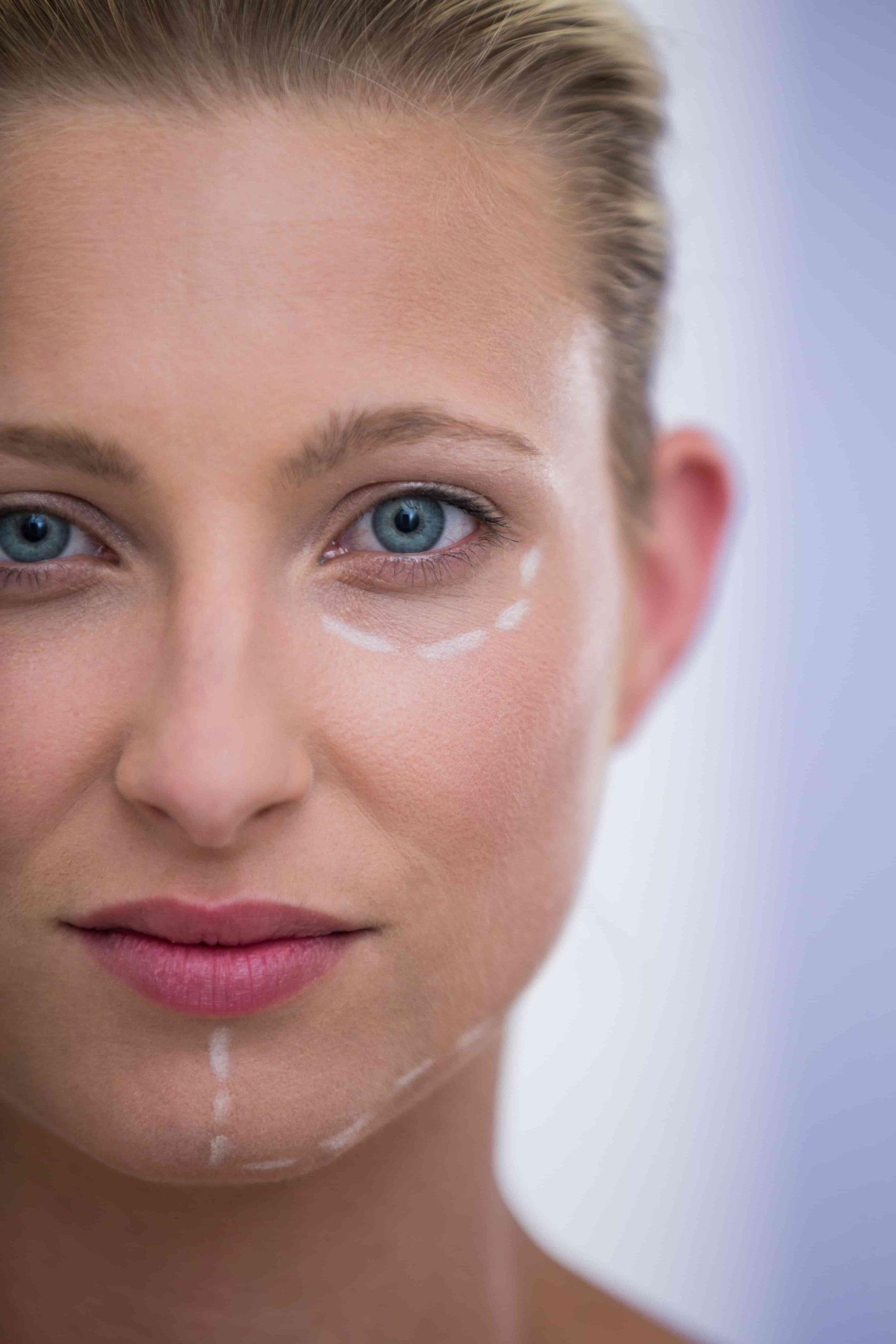 woman with marks drawn botox procedure 1 scaled