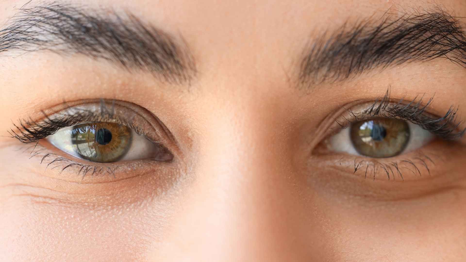 tratamiento estetico ojeras cordoba