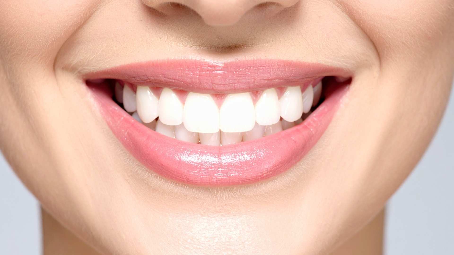 sonrisa gingival