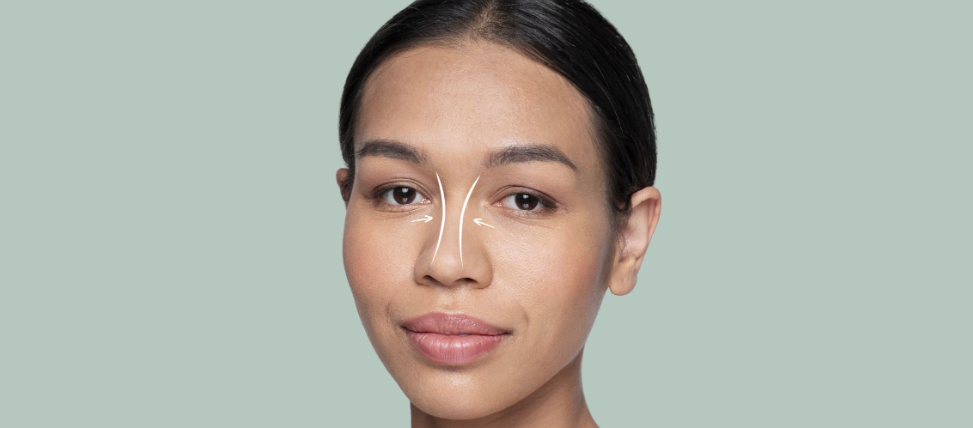 Recuperación postoperatoria de rinoplastia ultrasónica
