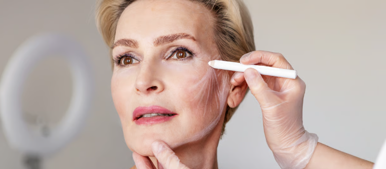 Consejos para postoperatorio del lifting facial