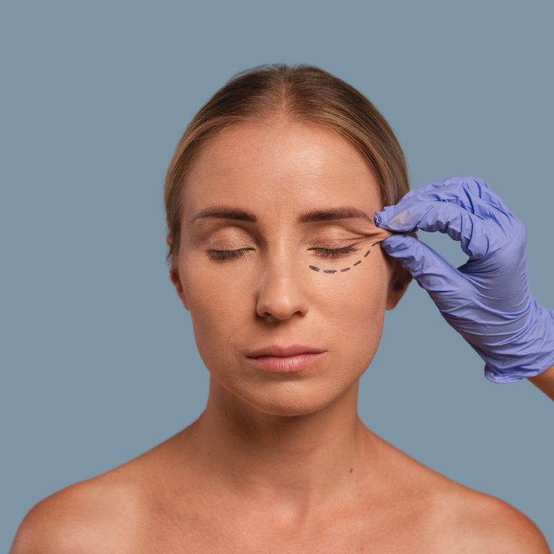 Blefaroplastia-servicio-imagen