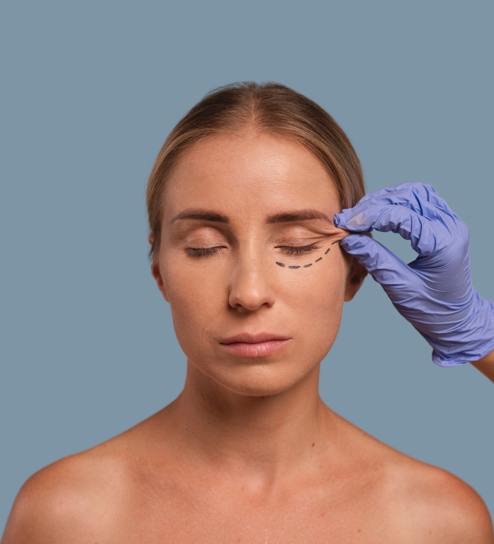 Blefaroplastia-servicio-imagen